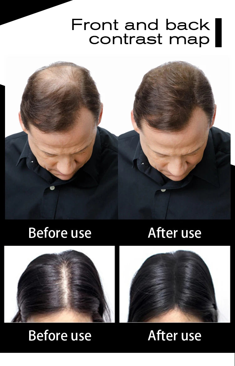 Sevich 10 Color Hair Fibers Keratin Hair Loss Building Fiber 25g/100g Hair Loss Concealer Instant Wig Regrowth Powders Black