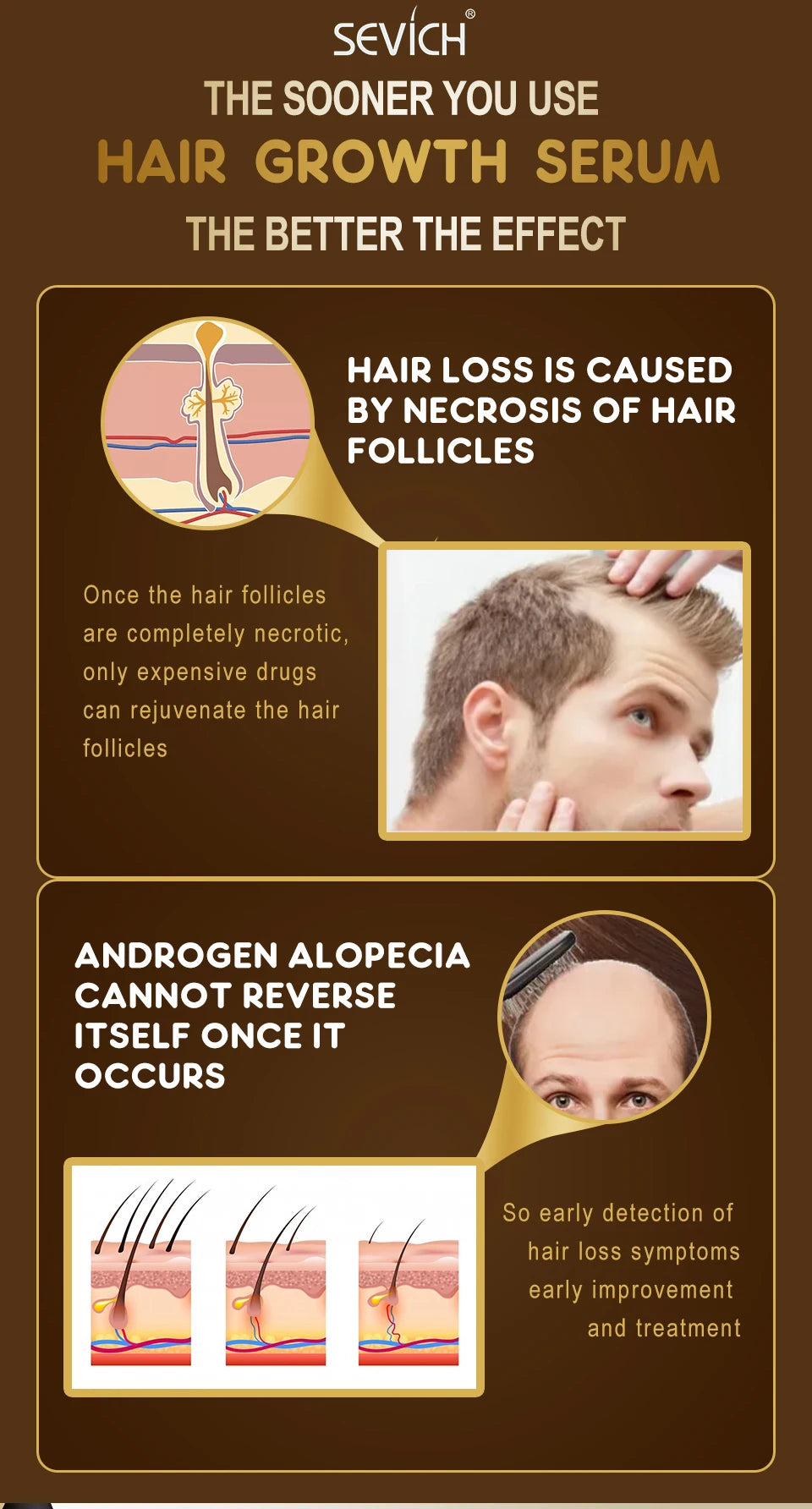 Sevich Herbal Fast Hair Growth Oil With Massage Roller 20ml Hair Loss Treatment Ginger Extract Growing Serum Hair Loss Products