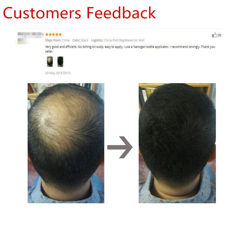Sevich 10 Color Hair Fibers Keratin Hair Loss Building Fiber 25g/100g Hair Loss Concealer Instant Wig Regrowth Powders Black