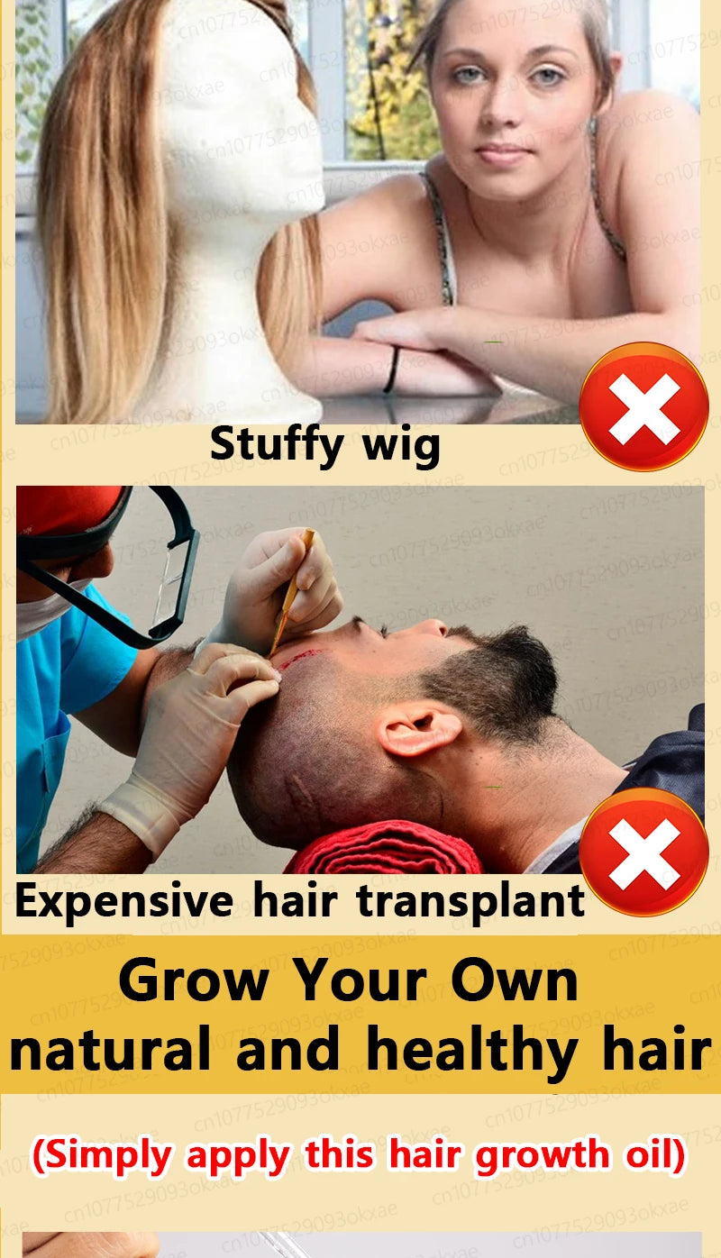 No longer worry about baldness, you will grow thick hair by using this product
