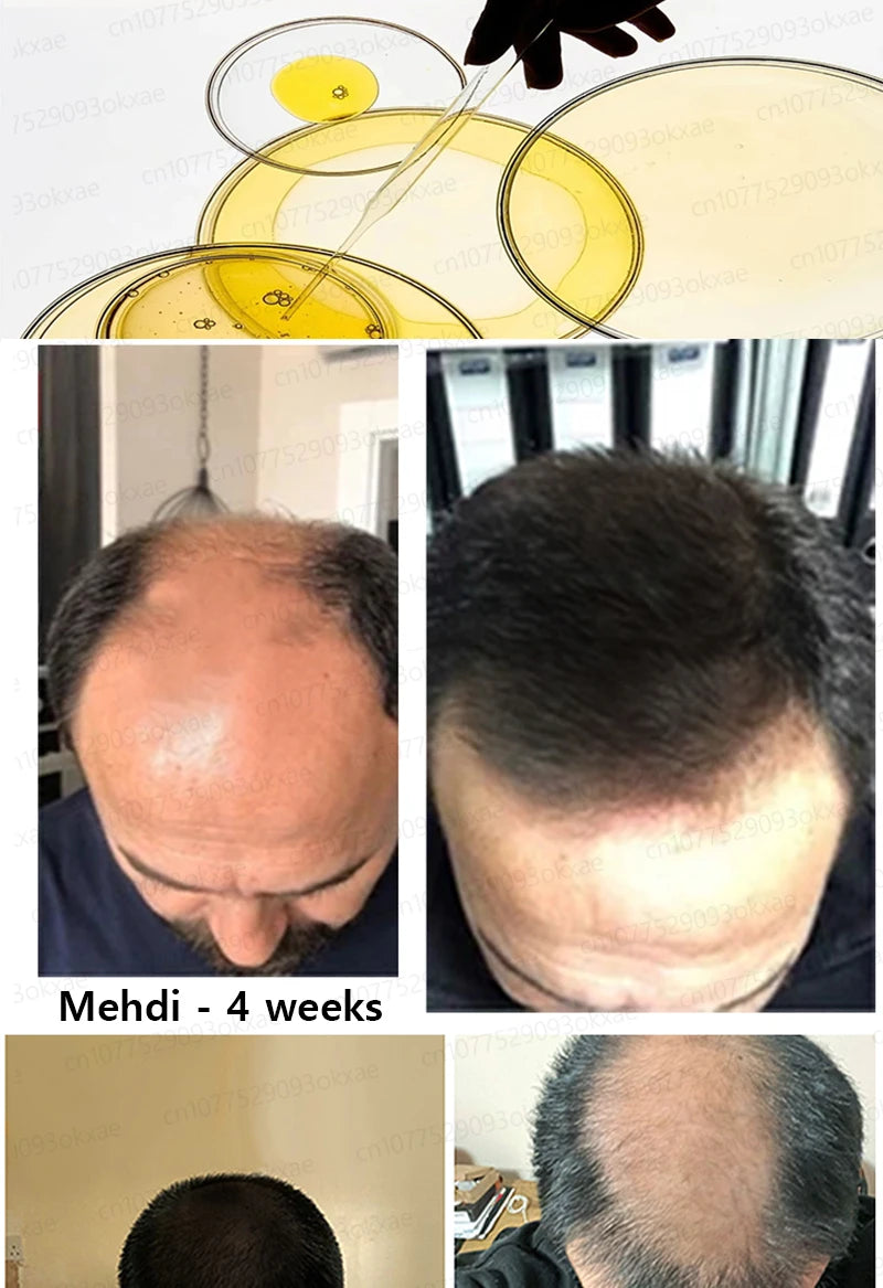 No longer worry about baldness, you will grow thick hair by using this product