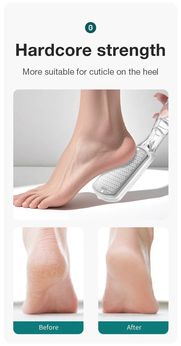MR.GREEN Pedicure Tools Foot File Heels Rasps callus remover for feet Scraper With Storage Box Stainless Steel File