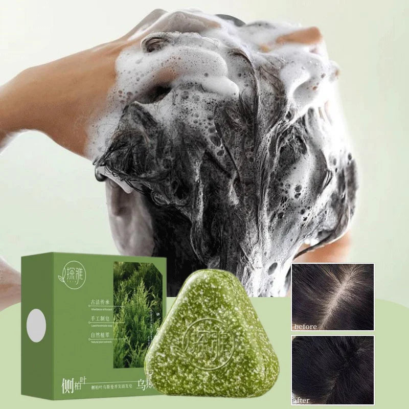 Natural Hair Loss Control Soap Hair Loss Control Oil Control Activates Follicles Handmade Herbal Shampoo Bar For Men Women