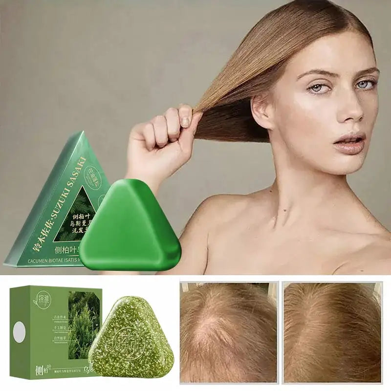Natural Hair Loss Control Soap Hair Loss Control Oil Control Activates Follicles Handmade Herbal Shampoo Bar For Men Women