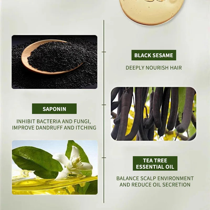 Natural Hair Loss Control Soap Hair Loss Control Oil Control Activates Follicles Handmade Herbal Shampoo Bar For Men Women
