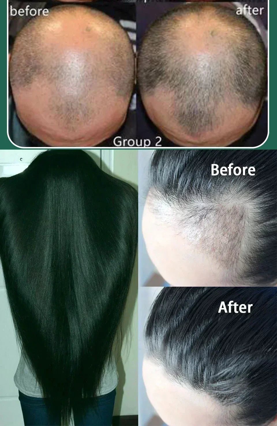 Hairs Care Serum Oil Baldness Repair Hereditary Hair Loss Postpartum Hair Loss Seborrheic Hairs Loss Hair Oil
