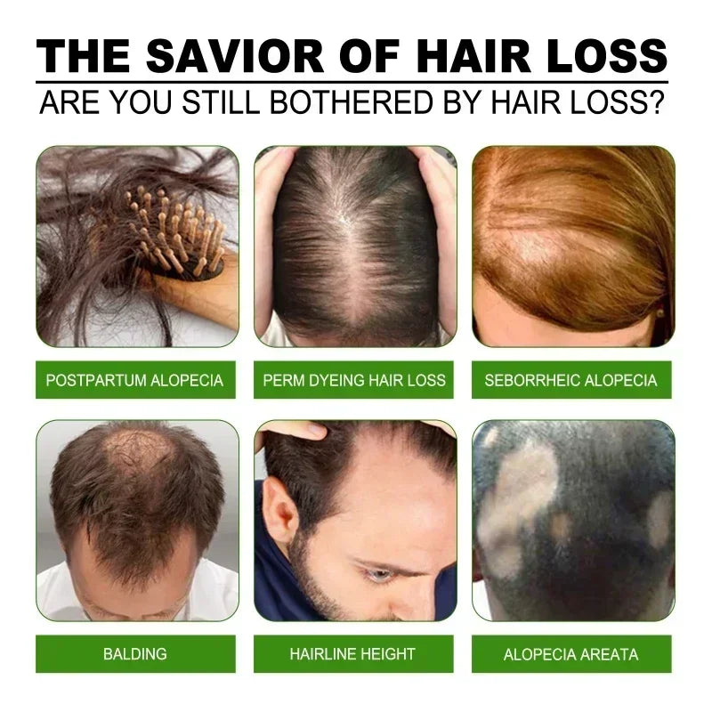 Hairs Care Serum Oil Baldness Repair Hereditary Hair Loss Postpartum Hair Loss Seborrheic Hairs Loss Hair Oil