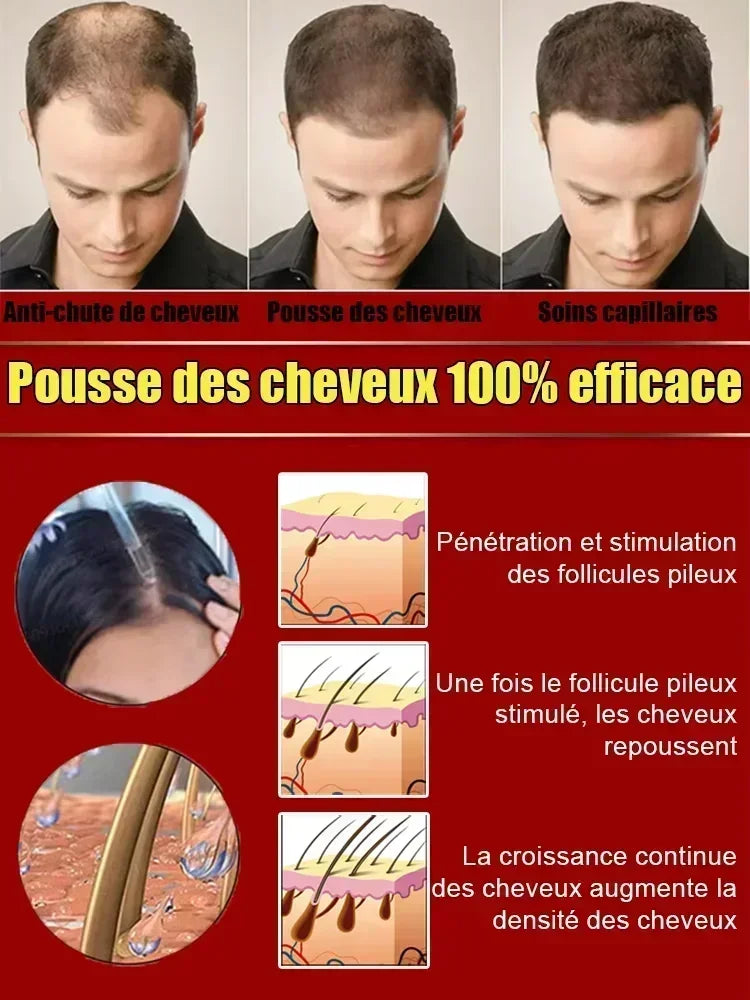 Hairs Care Serum Oil Baldness Repair Hereditary Hair Loss Postpartum Hair Loss Seborrheic Hairs Loss Hair Oil