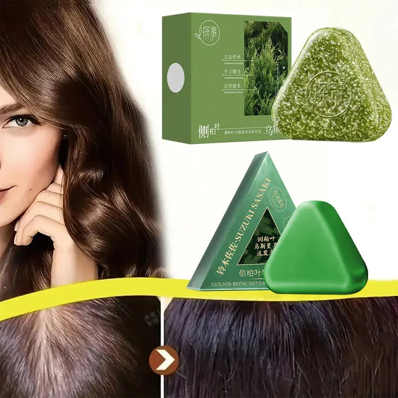 Natural Hair Loss Control Soap Hair Loss Control Oil Control Activates Follicles Handmade Herbal Shampoo Bar For Men Women