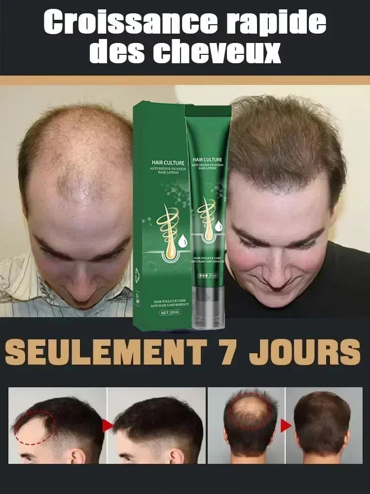 Hairs Care Serum Oil Baldness Repair Hereditary Hair Loss Postpartum Hair Loss Seborrheic Hairs Loss Hair Oil