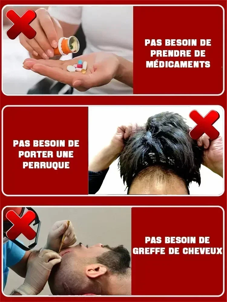 Hairs Care Serum Oil Baldness Repair Hereditary Hair Loss Postpartum Hair Loss Seborrheic Hairs Loss Hair Oil