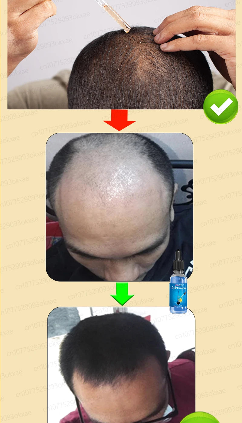 No longer worry about baldness, you will grow thick hair by using this product