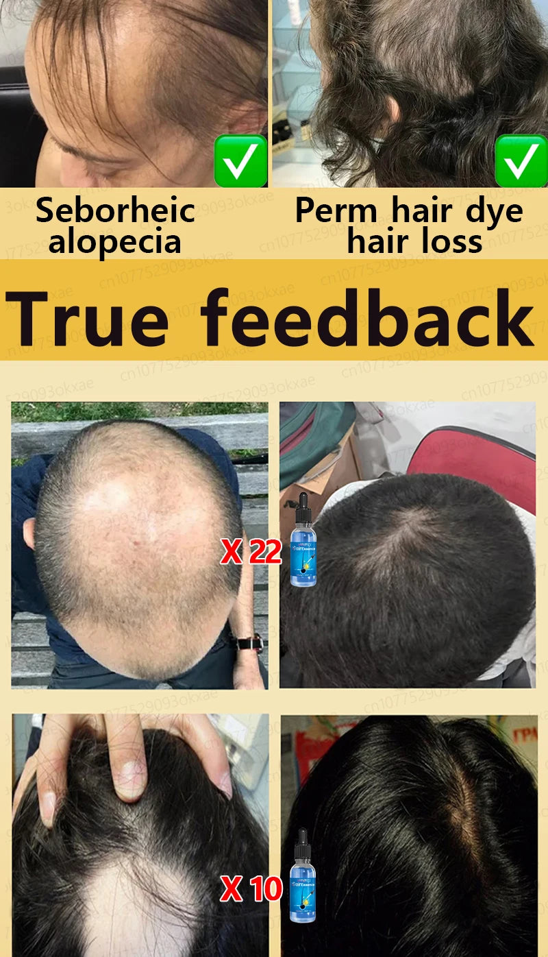 No longer worry about baldness, you will grow thick hair by using this product