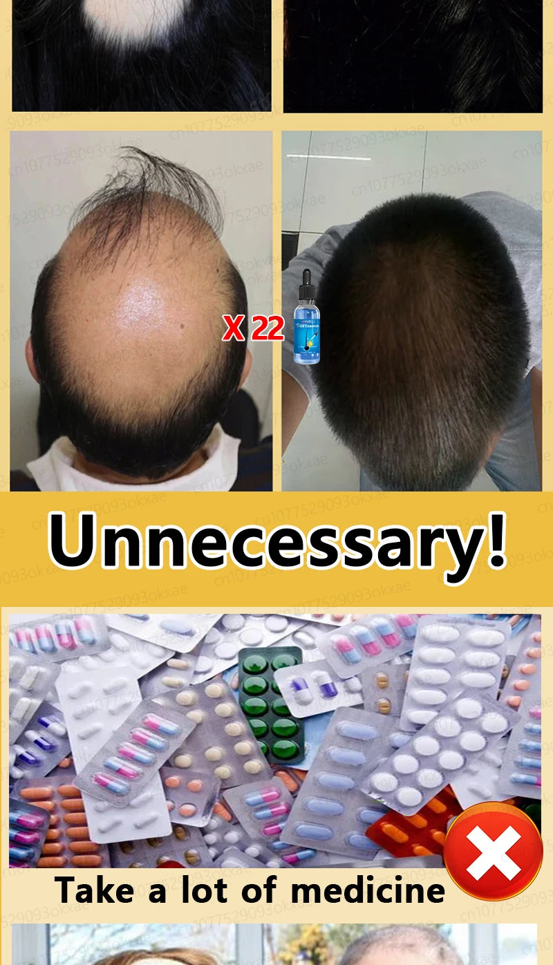 No longer worry about baldness, you will grow thick hair by using this product