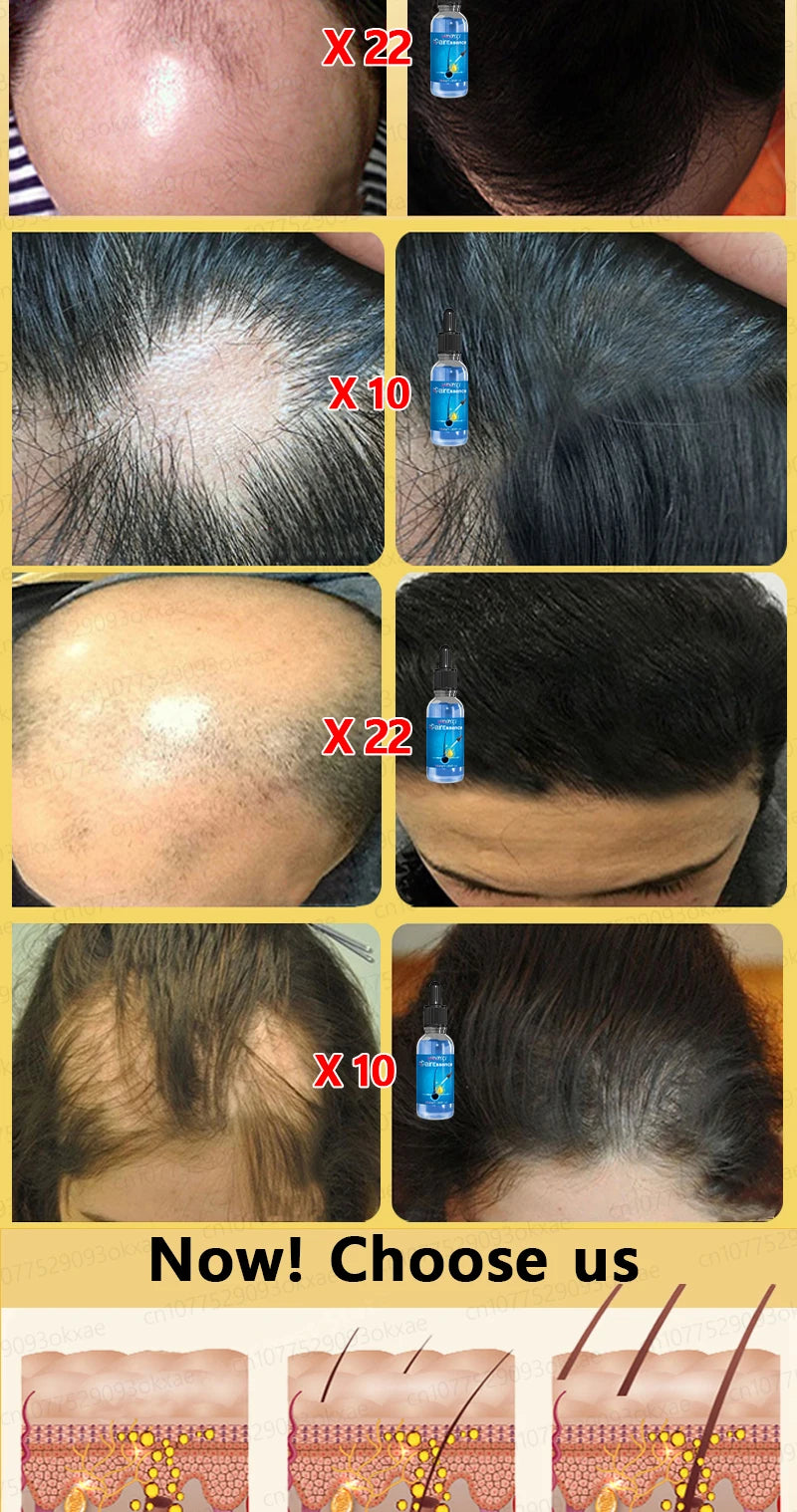 No longer worry about baldness, you will grow thick hair by using this product