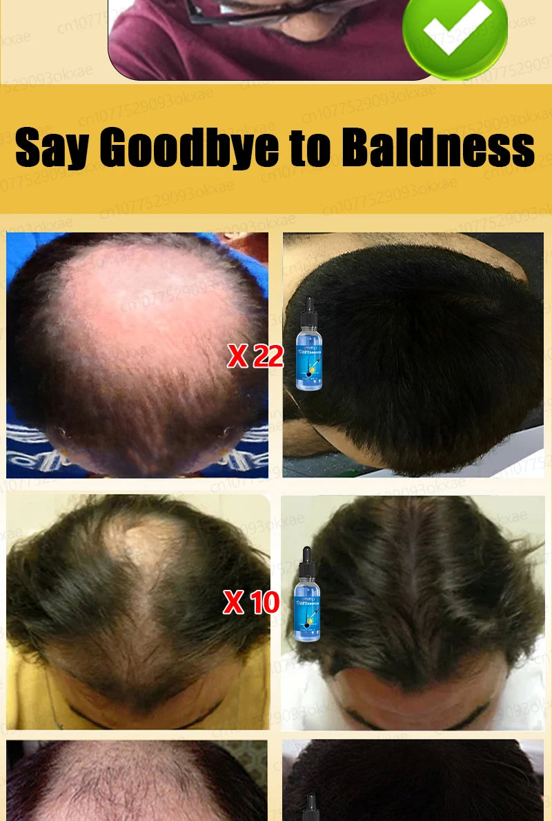 No longer worry about baldness, you will grow thick hair by using this product
